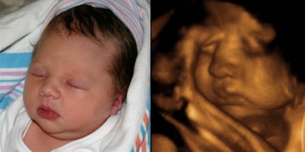 Picture an Angel 3d & 4d Ultrasounds