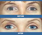 Best Permanent Makeup By Jeffery Lyle Segal