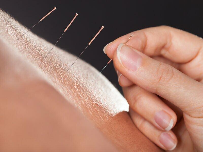 Giddings Acupuncture Practice LLC