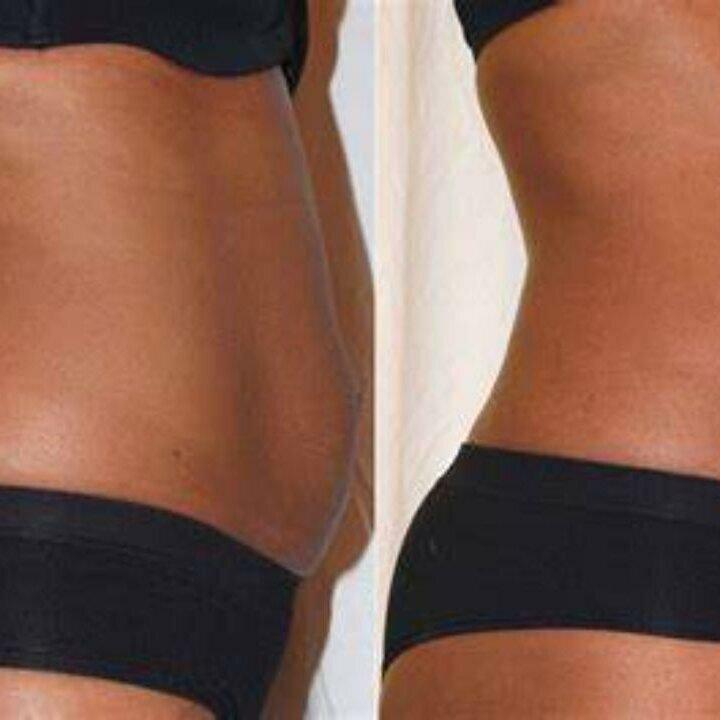 Skulpted Skin the Body Contouring Specialist