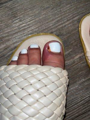 This is how she left my toe. AND she shaped them so ugly as well.