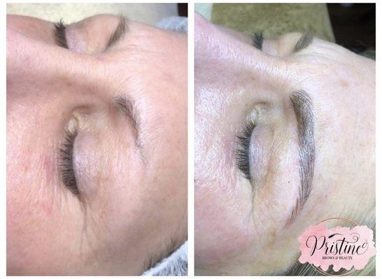 Service: Microblading