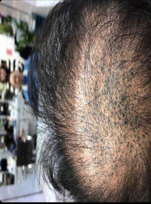 Back of dads head. Ink bled around skin. An experience artist would make this look like tiny dots to look like hair follicles