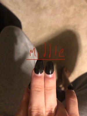 Uneven middle finger nails