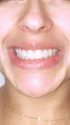 Beautiful client smile.