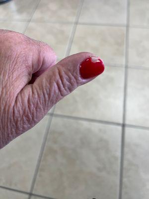 Chipped nail