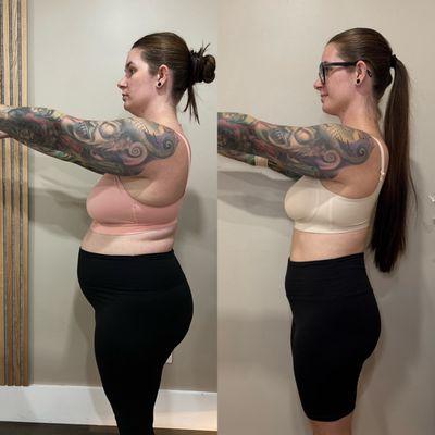 Before and after--down 45 pounds.