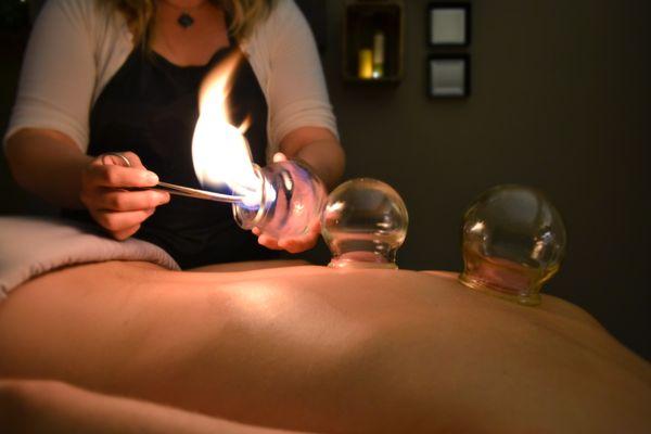 Fire Cupping