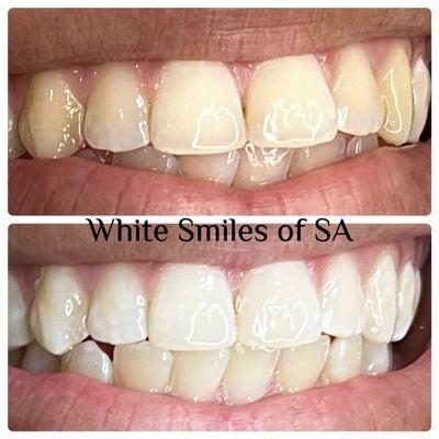 White Smiles Of SA