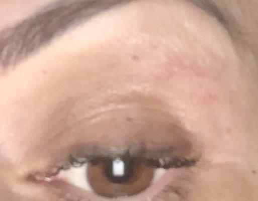 Chewed up below my brows! Most painful threading I hv had