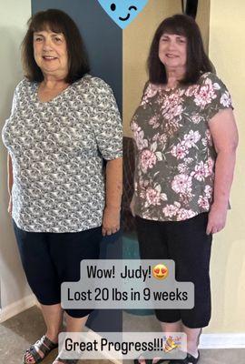 Semaglutide Weight Loss once a week injection