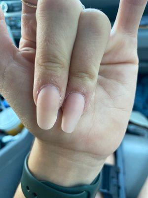 In this photo you can clearly see the difference in shapes between the two nails