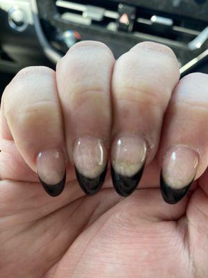 Bad nails