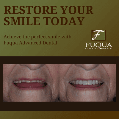 Before & After Results at Fuqua Advanced Dental | Southlake, TX