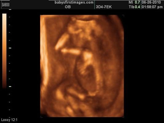 My baby boy! 3D Image