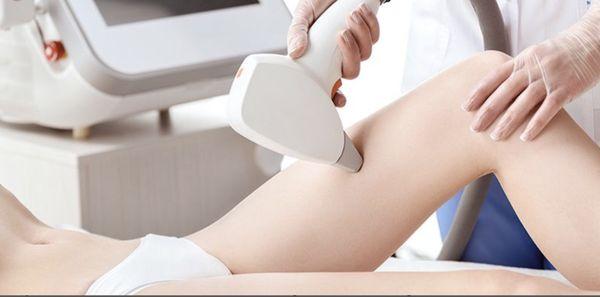 LightSheer Desire Laser Hair Removal