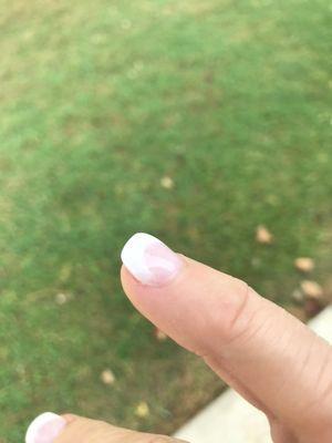 White is so crooked, also thick and pointing up away from my finger