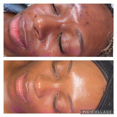 Sken Care at its finest at our Sken Fetysh hub.. join us if you wan to have a more radiant appearance