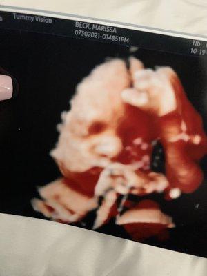 Tummy Vision 3D/4D Ultrasound & Gender Reveal