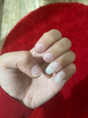 Nails completely damaged