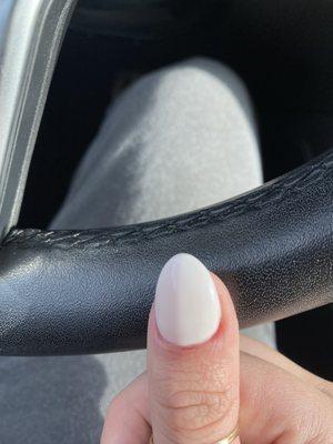 nail looks like an egg