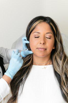 Dermal filler can be applied to the jawline to achieve a more streamlined silhouette.