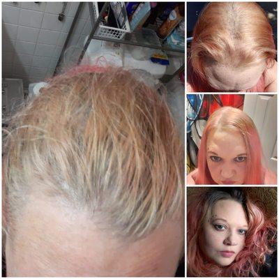 The bottom right photo is my untreated roots. 20 days later in the big picture, is my orange hair falling out that was supposed to be blonde