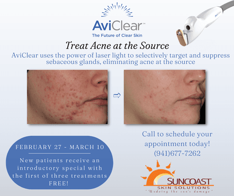 Struggling with Acne? Give us a call to learn more about AviClear!