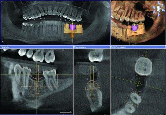 Smile Magic Dentistry - Dr Ray Nazir