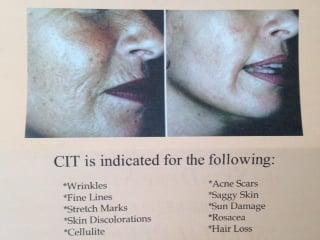 Specializing in Collagen Induction Therapy                                &               Customized Skin Care