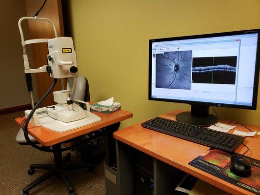 Macular and Glaucoma detection