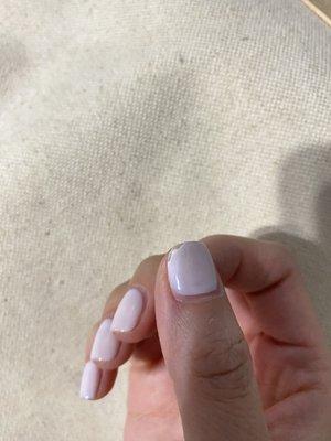 Chipped nail