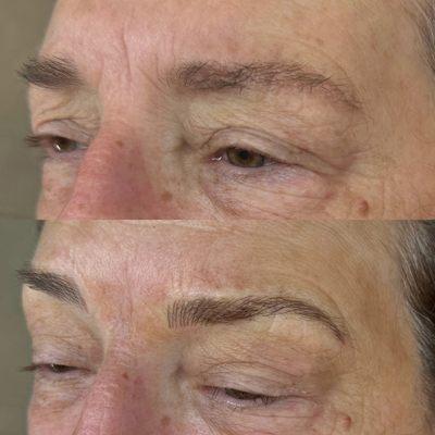 Before and after on a client