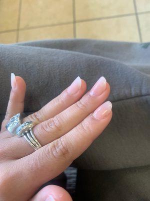 Picture of uneven, crooked nails.