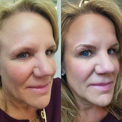 3d Micropigmentation (Permanent Makeup)