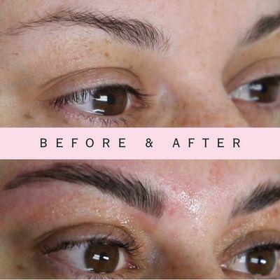 Brow Lamination