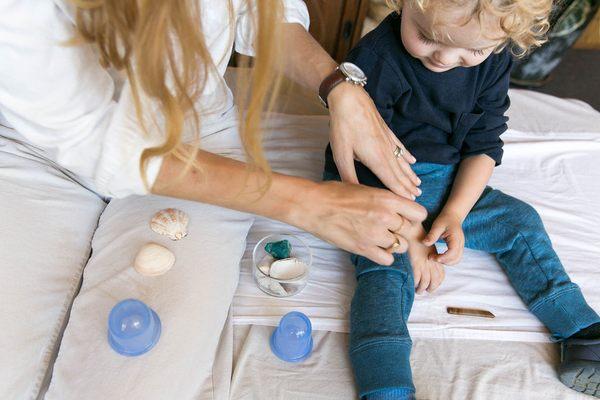 Pediatric Acupuncture treatment for toddlers