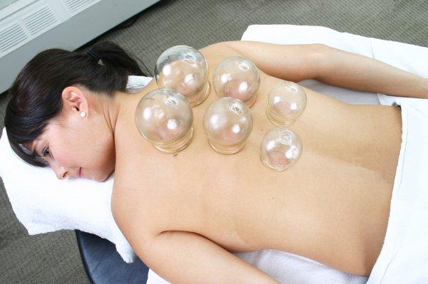 Cupping to help with pain, Stress and tension.