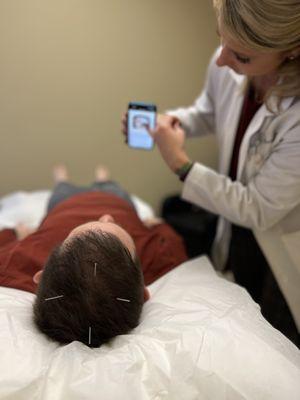 Dr. Brandy Brown educating patients during treatment - Acupuncture for TBI