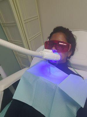 Teeth whitening worth the pain