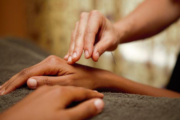 Acupuncture point used to diminish headaches