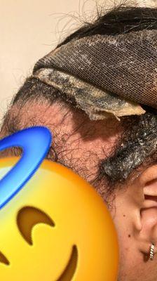 The hair THATS stuck to the wig cap