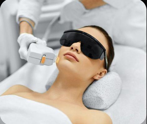 IPL photofacial