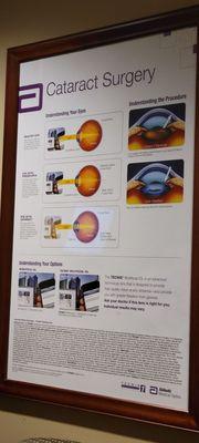 Informational poster for what happens during cataract surgery