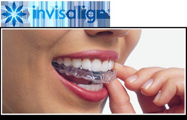 Invisalign