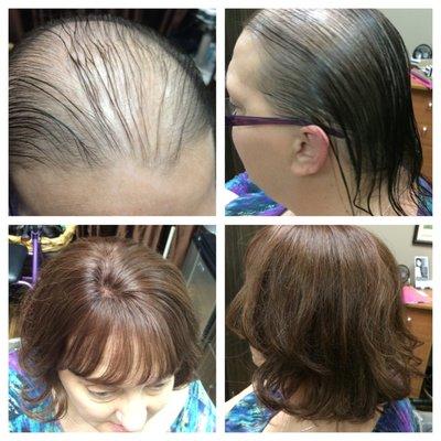 Alopecia Solution, custom human hair piece