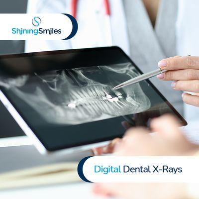 Digital Dental X-Rays at Shining Smiles Family Dentistry in Marietta, GA