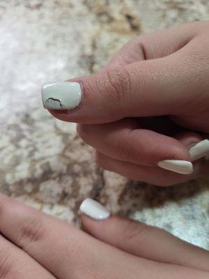 My daughter's thumb nail that is cracked and peeled after one day.