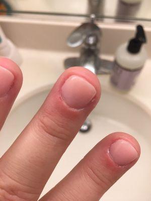 See my red cuticles and cuts in the picture