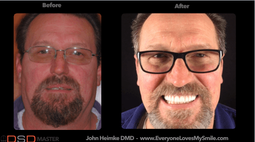 John Heimke, DMD - The Facial Aesthetic Designer